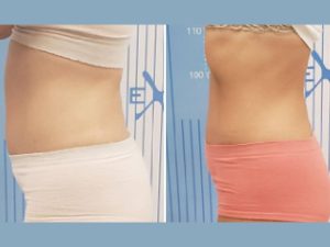 با دی اکتور و اگزیمیا