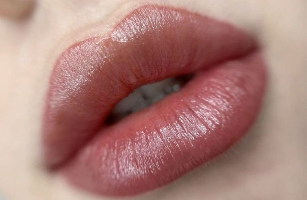 جوانسازی لب کلینیک زیبایی ترمه