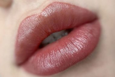 جوانسازی لب کلینیک زیبایی ترمه