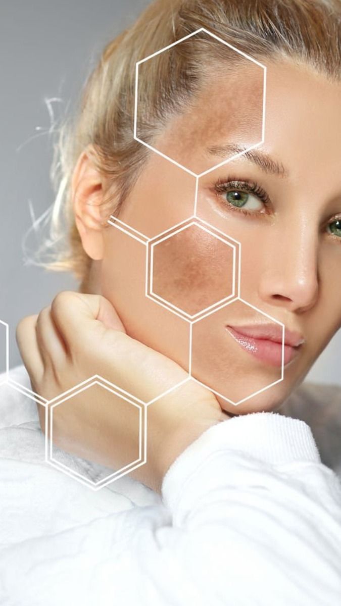  جوانسازي با هايفوتراپي (HIFU)