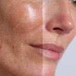 کانتورینگ و فرم دهی صورت