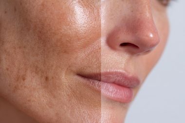 کانتورینگ و فرم دهی صورت