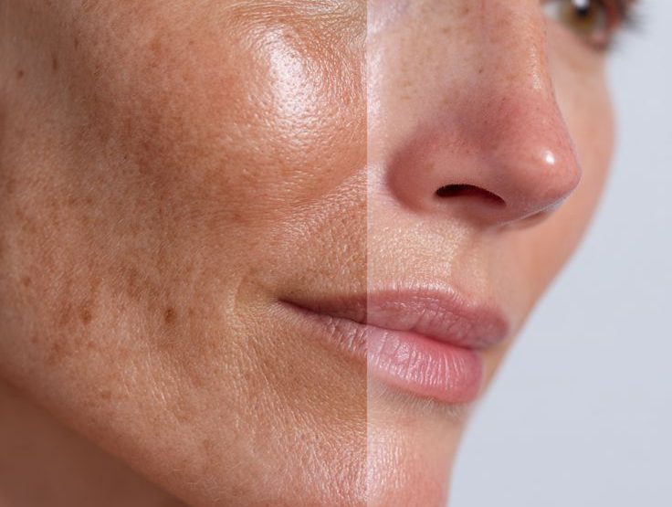 کانتورینگ و فرم دهی صورت