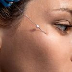 با نخ آپتوس