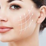 لیفت گونه کامرانیه