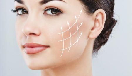 لیفت گونه کامرانیه