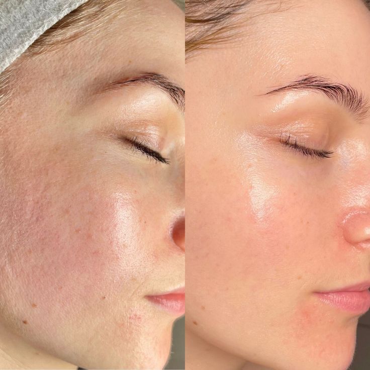 کانتورینگ و فرم دهی صورت